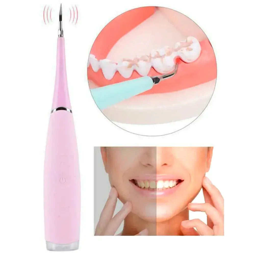 Electric Cleaner®/ Limpiador dental - Pitipa.mx