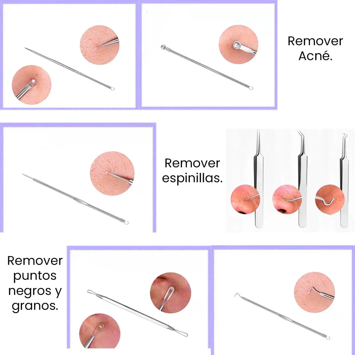 Kit de herramientas para espinillas y acné 🟢 Calidad Plus